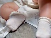 只剩一个卵巢能否做试管婴儿